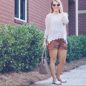 Faux Leather Scalloped Shorts